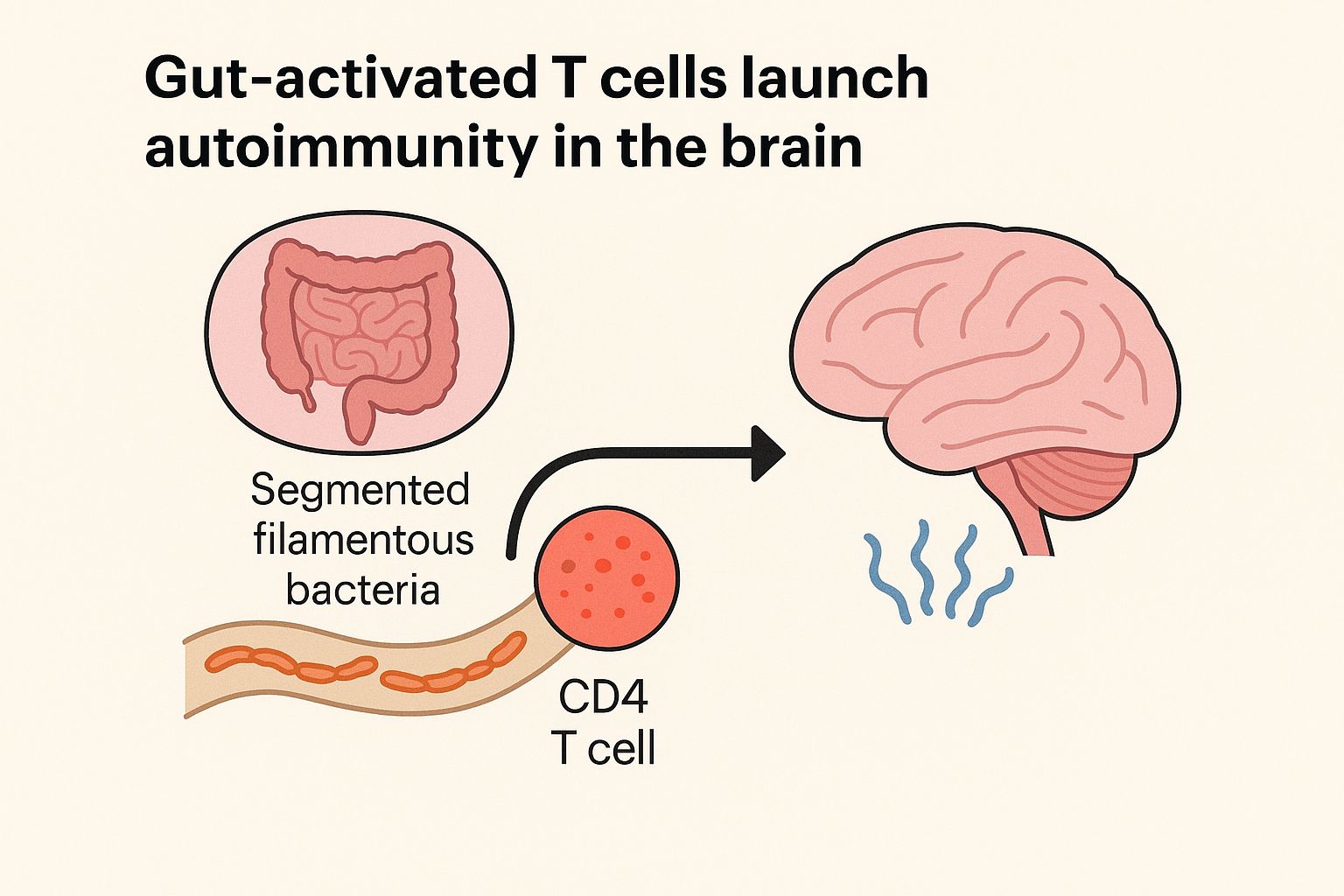 Gut Activated T cells launch autoimmunity in the brain