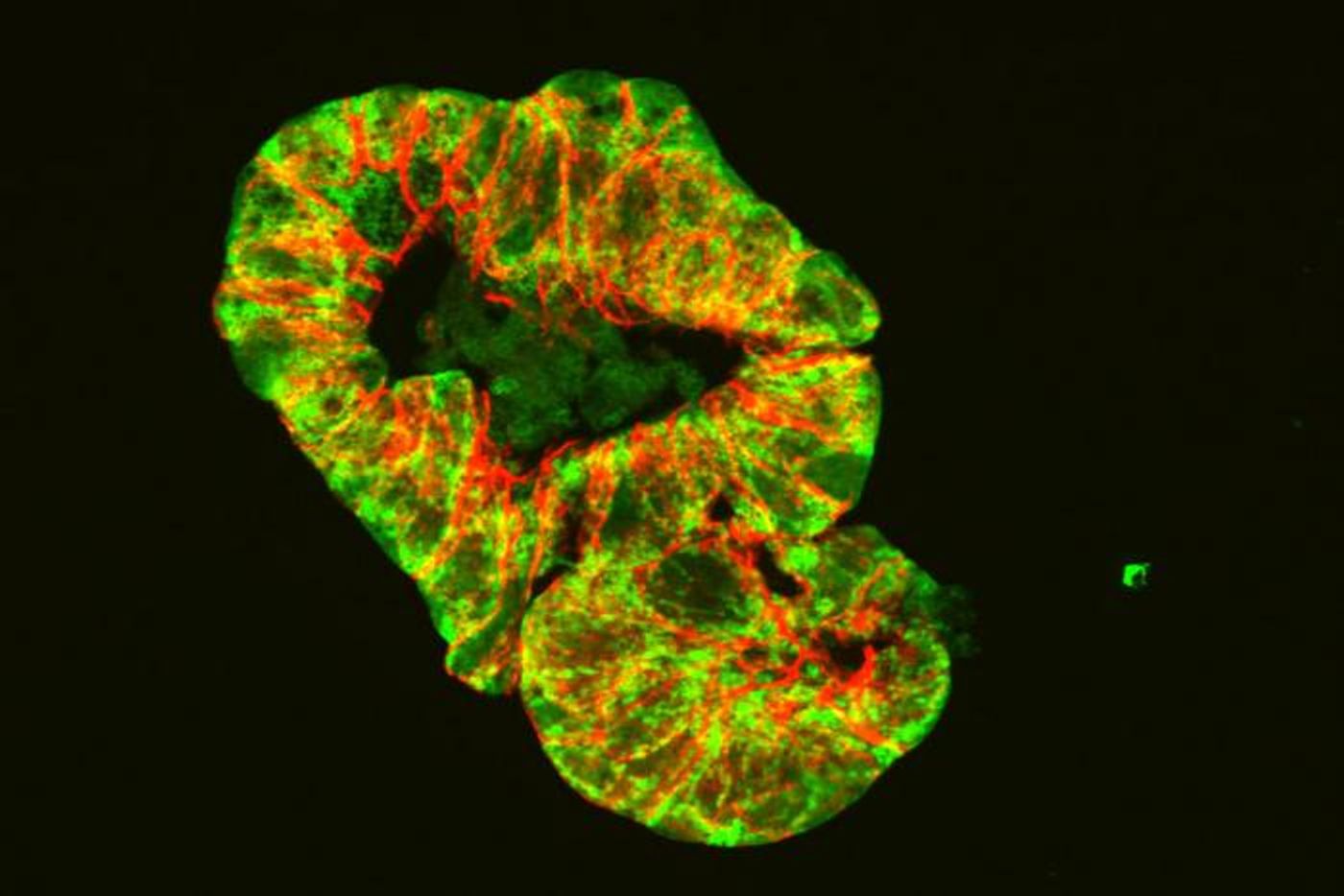 Mitochondrial Dysfunction Disrupts Microbiome Leading to Crohns Disease