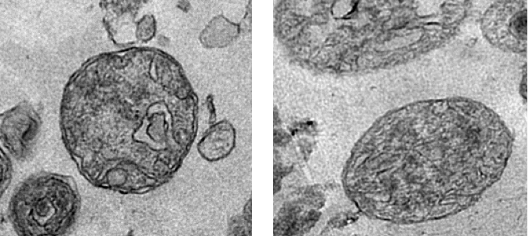 Mitochondrie extracellulaire circulante Alain R. Thierry Inserm