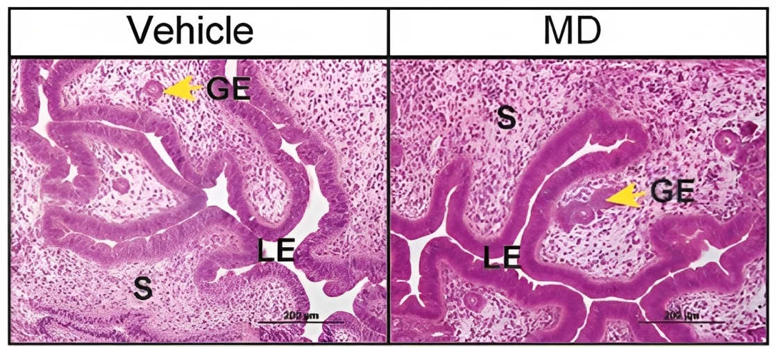 New study puts gut microbiome at the center of Parkinsons disease pathogenesis